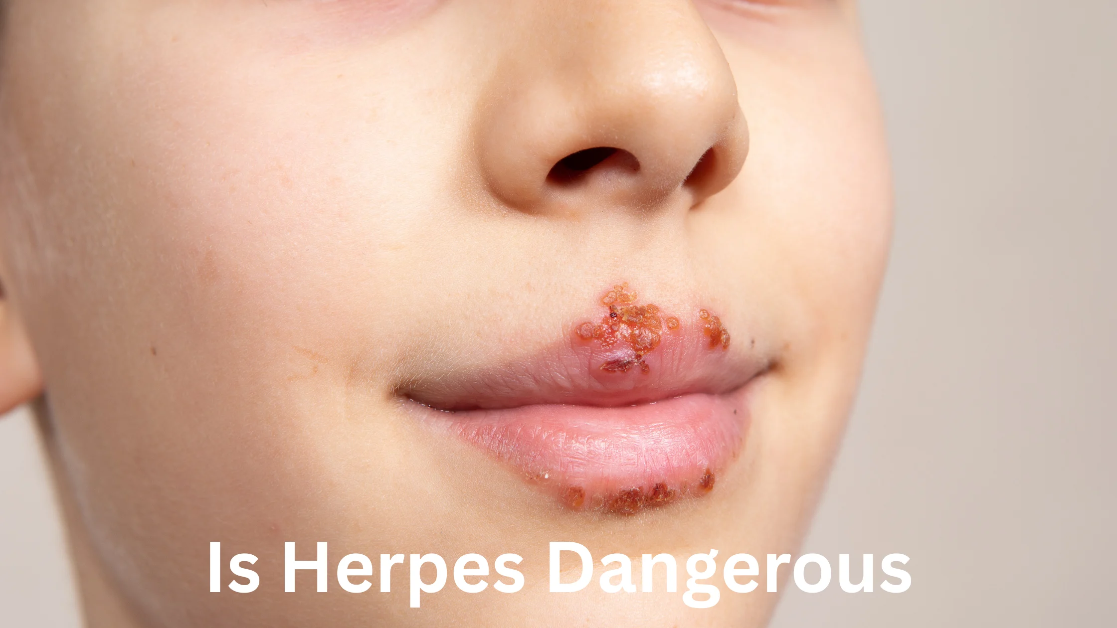 Is Herpes Dangerous?