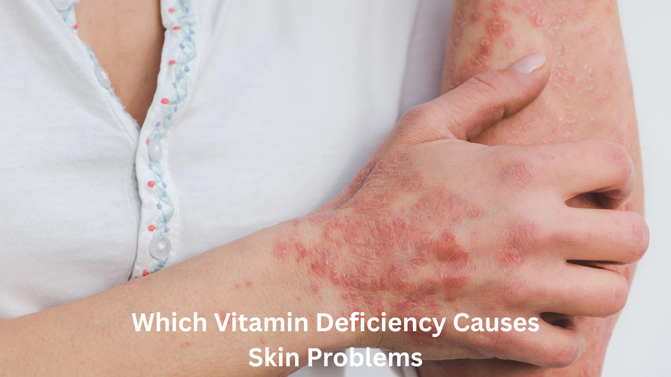Which Vitamin Deficiency Causes Skin Problems?